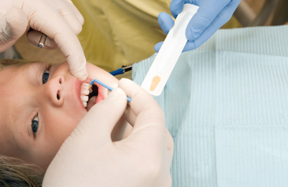 Role Of Fluoride In Pediatric Dentistry - Pediatric Dentist Cypress