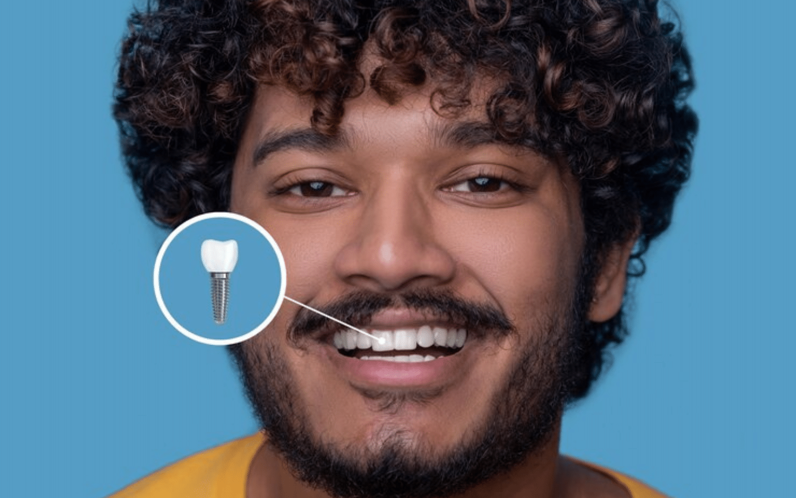 how to care for your dental implants for longevity