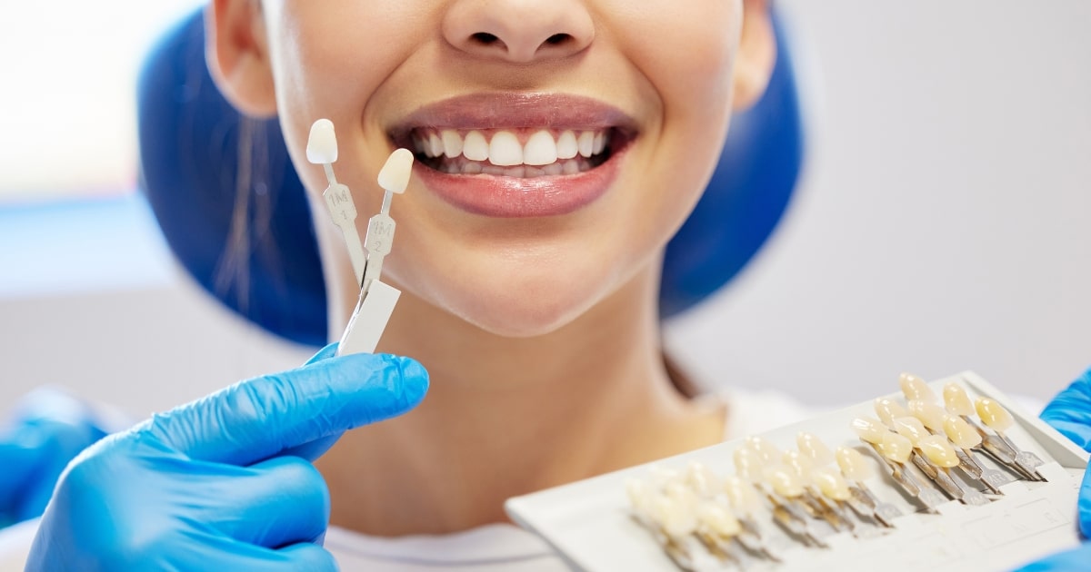 why veneers are the perfect solution for dental imperfections