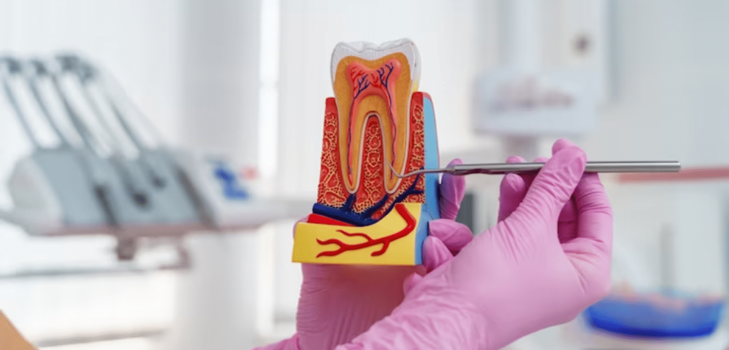 signs you may need a root canal in cypress
