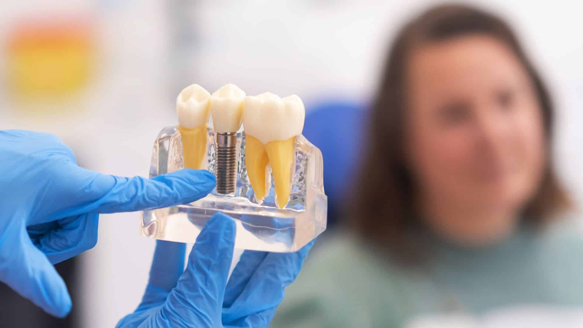 Can Dental Implants Enhance Chewing & Improve Digestion
