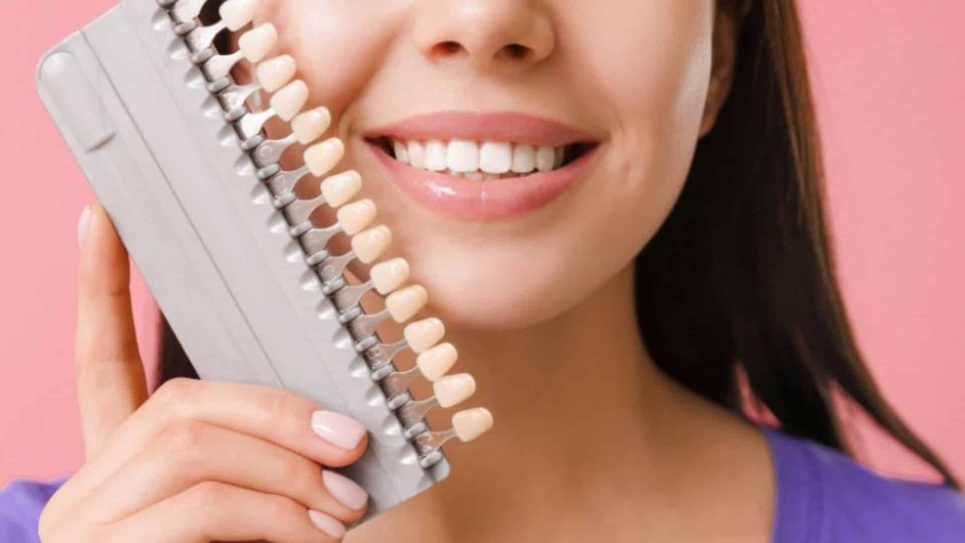 Can You Still Get Cavities with Veneers What to Watch For