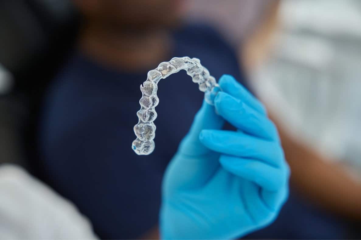 simple tricks to stay minty clean with invisalign