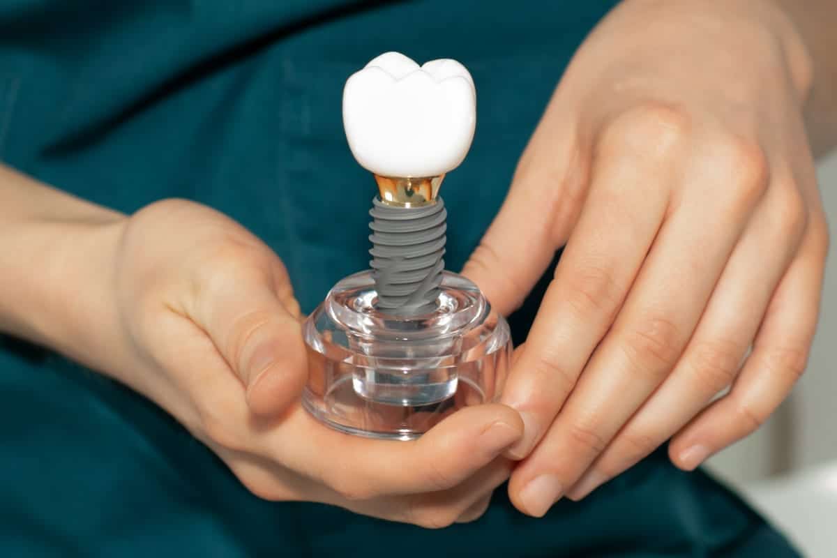 Dental Implants in Cypress