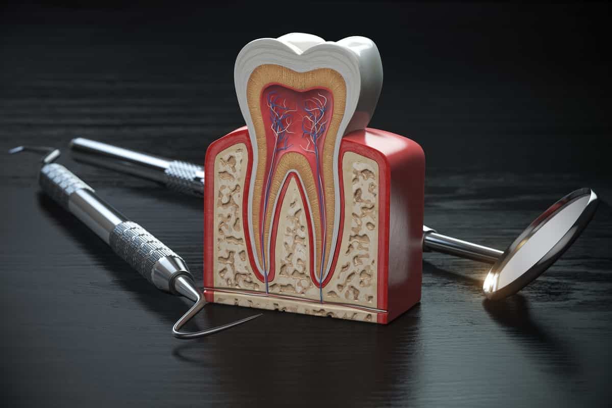Root Canal Treatment in Cypress