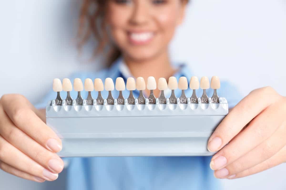 Veneers in Cypress