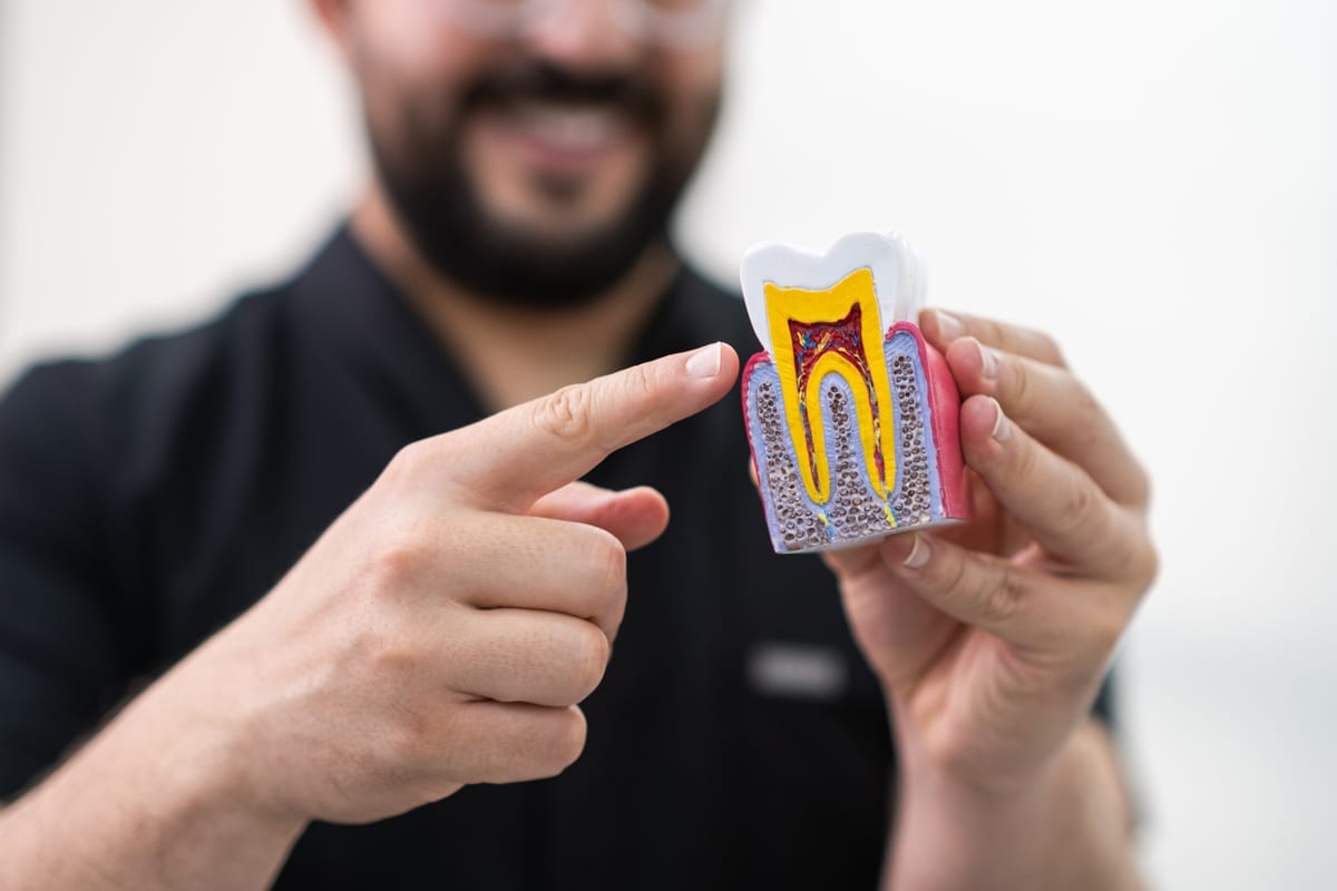 Root Canal Treatment in Cypress